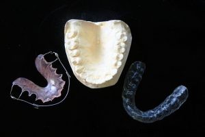 Impression 3D avec résines : Guide complet des technologies, matériaux et applications