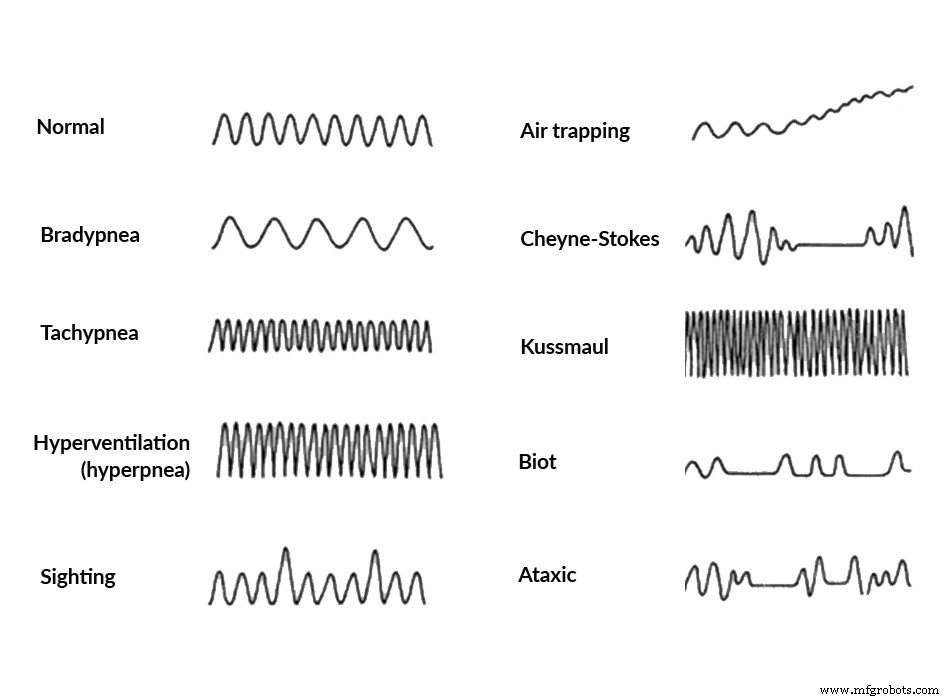 Radar mmWave pour monitoring sans contact de la fréquence cardiaque et respiratoire