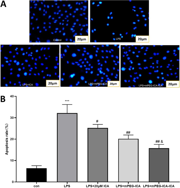 Nanoparticules de mPEG chargées d icariine : protection renforcée contre la cardiotoxicité induite par LPS dans les cellules H9c2