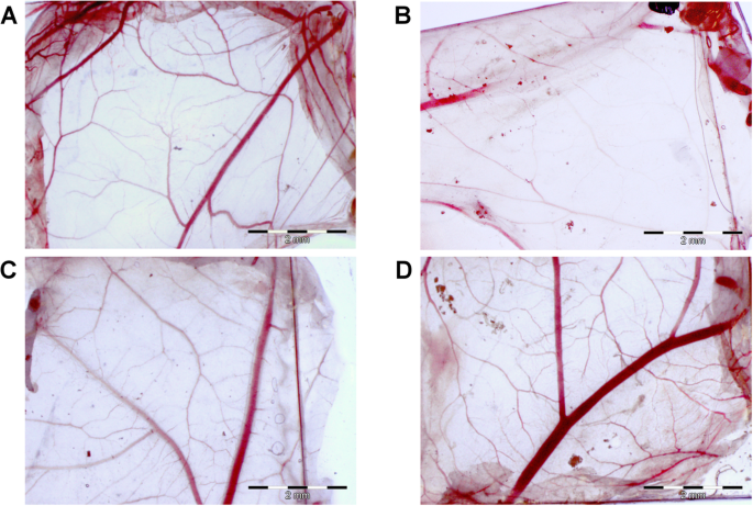 Réduction de la cytotoxicité des revêtements nanoparticules d argent par oxyde de graphène : performance antibactérienne et biocompatibilité améliorées du nanocomposite Ag-GO