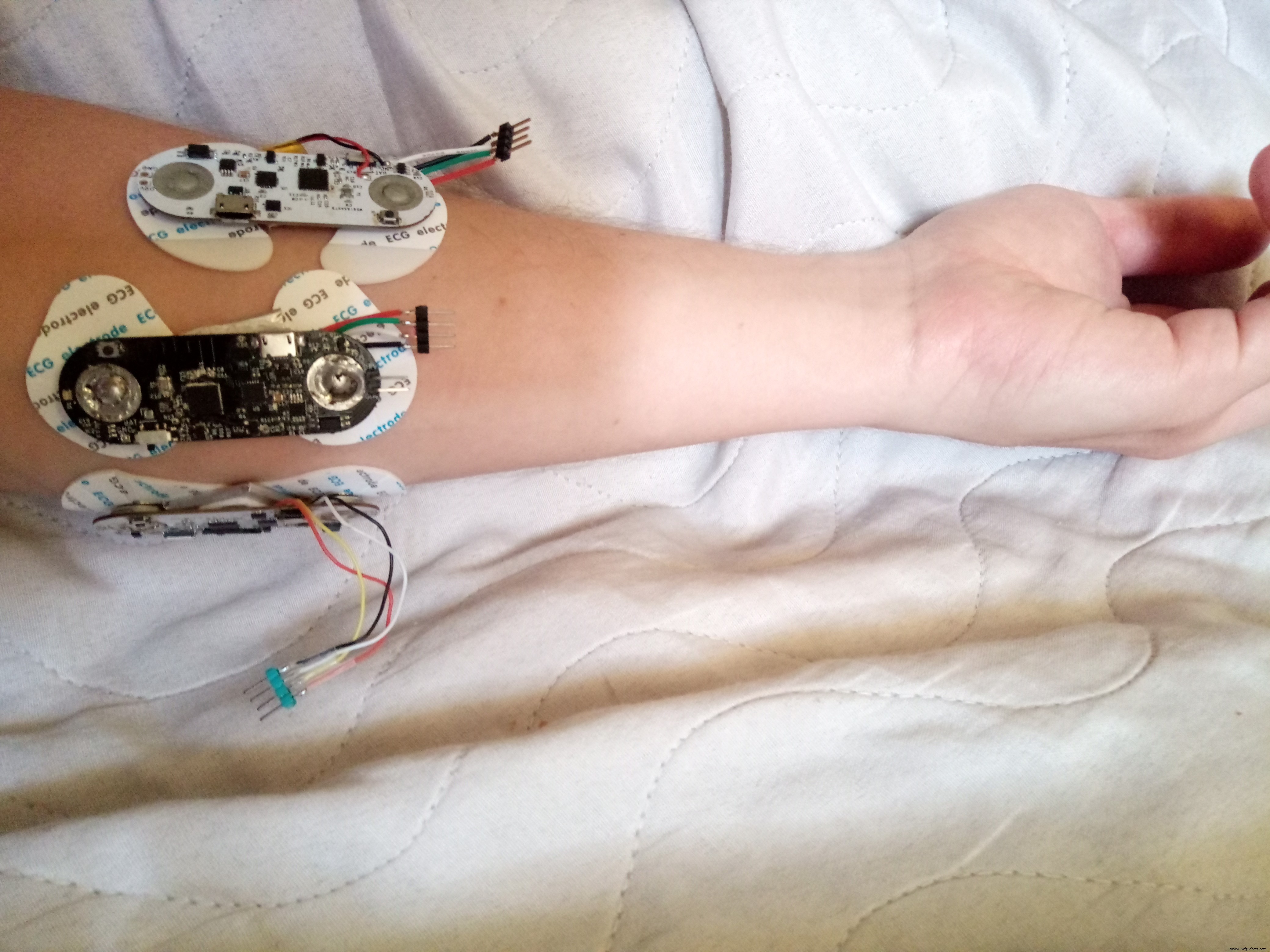 Main Robotique EMG Précise : Intégration InMoov et Guide de Construction